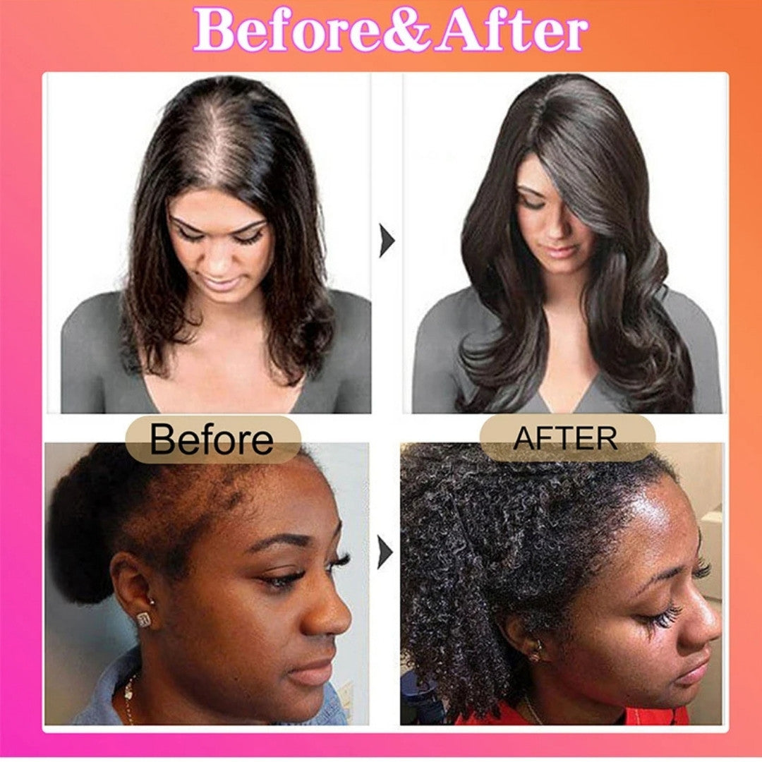 Raw Batana Oil Hair Growth Set